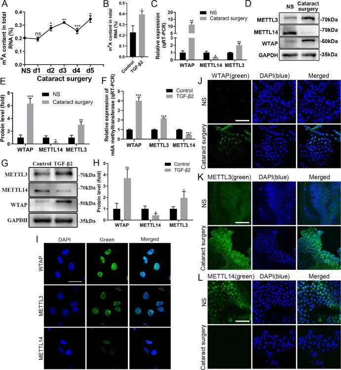 https://cdn.ncbi.nlm.nih.gov/pmc/blobs/d3d0/12068528/3f00f5297538/iovs-66-5-20-f004.jpg