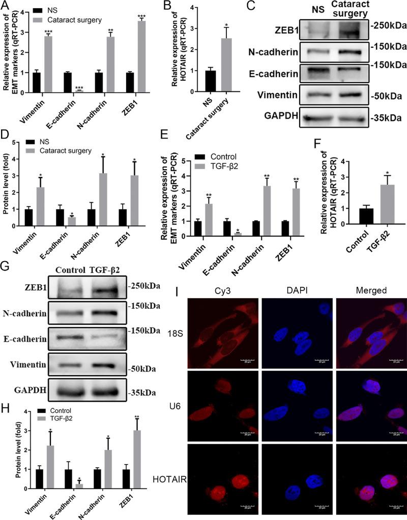 https://cdn.ncbi.nlm.nih.gov/pmc/blobs/d3d0/12068528/8de773c2b72f/iovs-66-5-20-f001.jpg