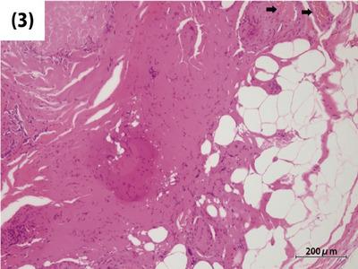https://cdn.ncbi.nlm.nih.gov/pmc/blobs/d3db/11106221/d6eae6d89a02/DEO2-5-e390-g001.jpg