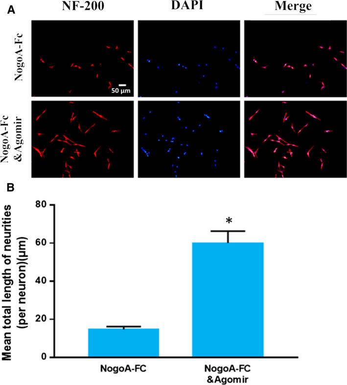 https://cdn.ncbi.nlm.nih.gov/pmc/blobs/d3dd/7686968/8fbe82785a58/JCMM-24-12285-g006.jpg