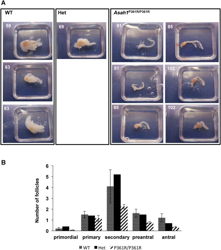 https://cdn.ncbi.nlm.nih.gov/pmc/blobs/d3df/3779446/d8b372dcf239/emmm0005-0827-f2.jpg