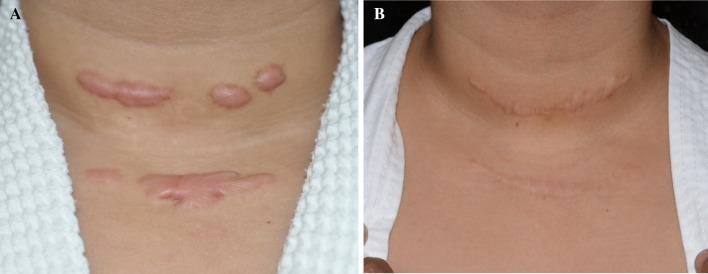 https://cdn.ncbi.nlm.nih.gov/pmc/blobs/d3df/5565660/842a8a62ba12/12325_2017_516_Fig3_HTML.jpg