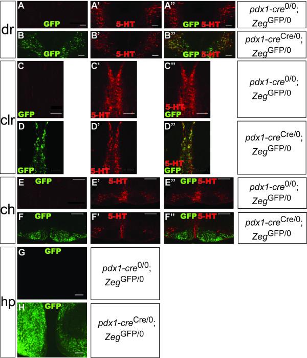 https://cdn.ncbi.nlm.nih.gov/pmc/blobs/d3e8/2966455/9cfed331758f/1423-0127-17-82-4.jpg