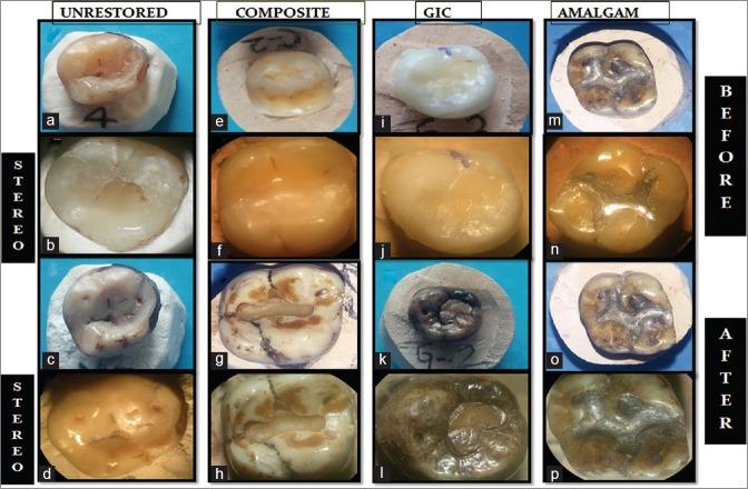 https://cdn.ncbi.nlm.nih.gov/pmc/blobs/d3ed/4860920/dfcd3b4b1954/JOMFP-20-154-g004.jpg