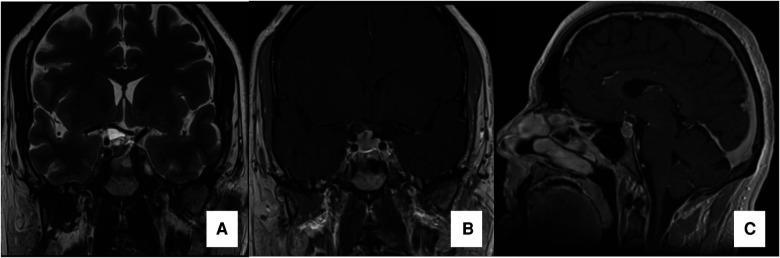 https://cdn.ncbi.nlm.nih.gov/pmc/blobs/d3f5/9990524/97c5b5a20211/fsurg-10-1073736-g001.jpg