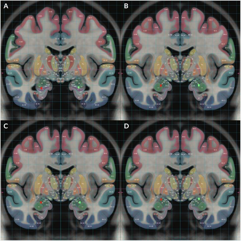 https://cdn.ncbi.nlm.nih.gov/pmc/blobs/d3fa/7052301/db6e29992c85/fnhum-14-00061-g002.jpg