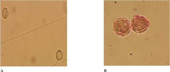 https://cdn.ncbi.nlm.nih.gov/pmc/blobs/d3fc/5985183/cb62e4ef72e4/ijpr-17-661-g001.jpg