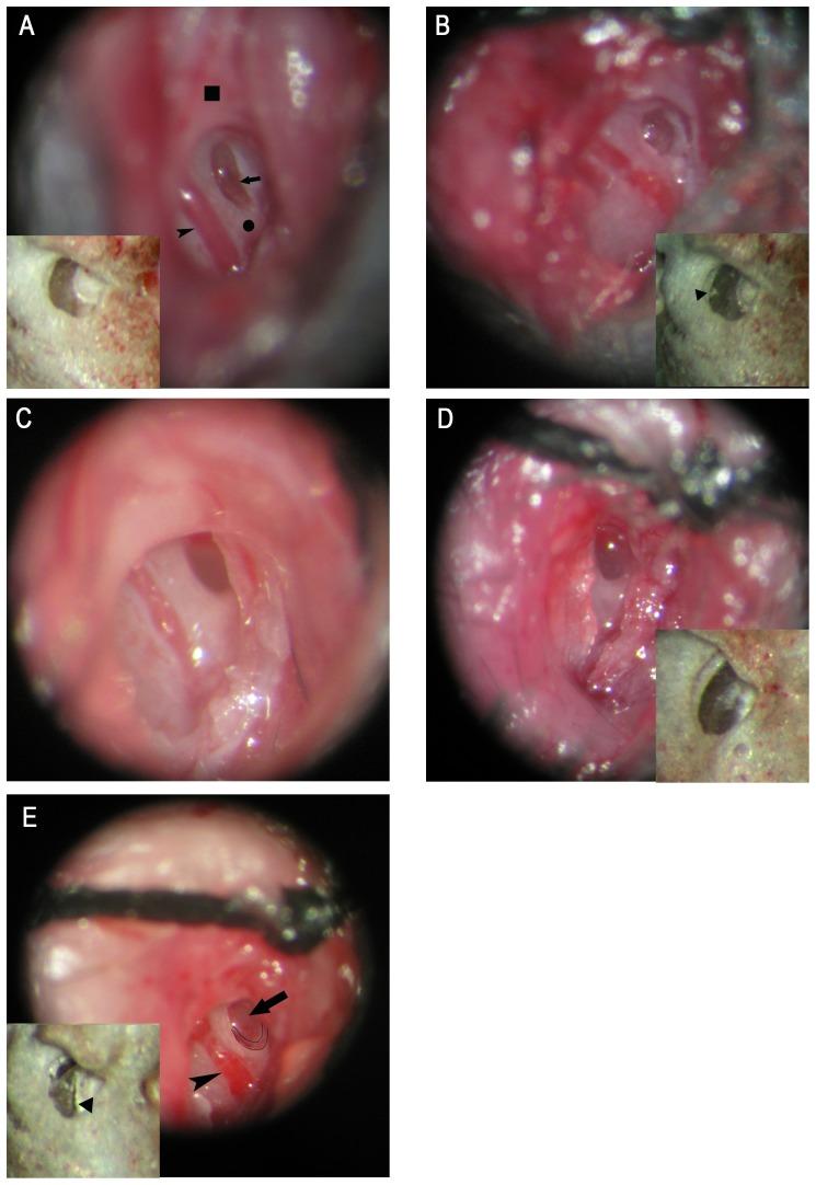 https://cdn.ncbi.nlm.nih.gov/pmc/blobs/d3fd/3422324/b7754206c9f9/pone.0043218.g001.jpg