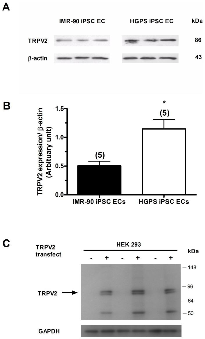 https://cdn.ncbi.nlm.nih.gov/pmc/blobs/d3fd/3903625/4f130f0a1ccb/pone.0087273.g003.jpg