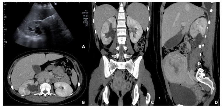 https://cdn.ncbi.nlm.nih.gov/pmc/blobs/d408/8947205/23d37d5f0012/diagnostics-12-00640-g011.jpg