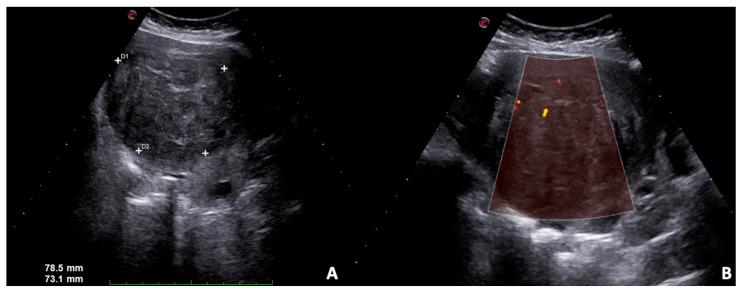 https://cdn.ncbi.nlm.nih.gov/pmc/blobs/d408/8947205/2b440d36215c/diagnostics-12-00640-g005.jpg
