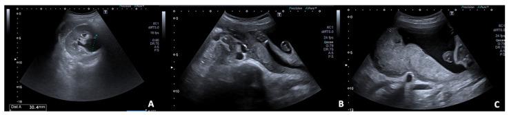 https://cdn.ncbi.nlm.nih.gov/pmc/blobs/d408/8947205/b4b82347909e/diagnostics-12-00640-g006.jpg