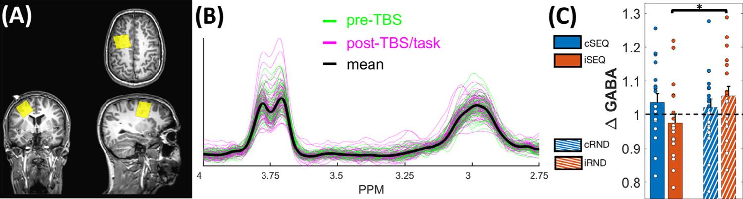 https://cdn.ncbi.nlm.nih.gov/pmc/blobs/d40d/8351752/90a212a432de/nihms-1723751-f0003.jpg
