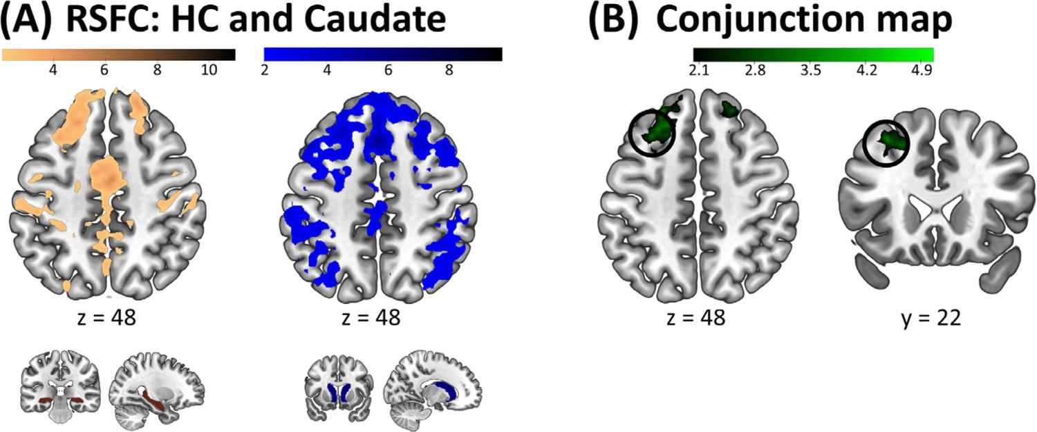 https://cdn.ncbi.nlm.nih.gov/pmc/blobs/d40d/8351752/9362ebdc16bb/nihms-1723751-f0002.jpg