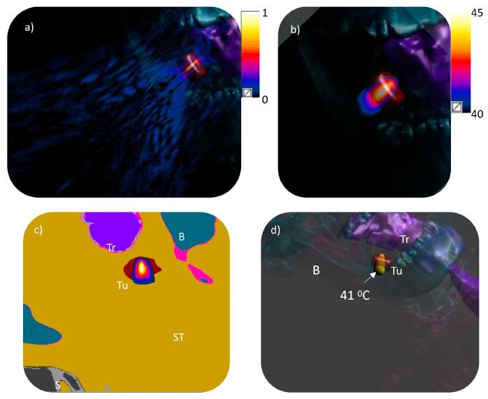 https://cdn.ncbi.nlm.nih.gov/pmc/blobs/d411/11760898/aed557398200/bioengineering-12-00014-g005.jpg