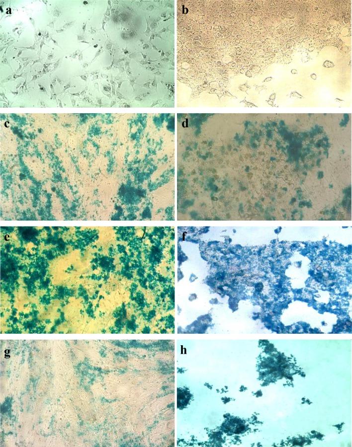 https://cdn.ncbi.nlm.nih.gov/pmc/blobs/d411/5597569/844c801bf454/40204_2017_68_Fig7_HTML.jpg
