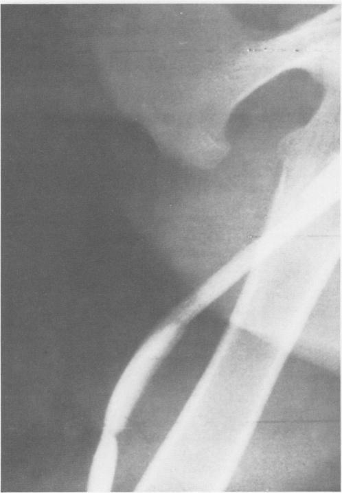 https://cdn.ncbi.nlm.nih.gov/pmc/blobs/d422/1396933/e1e582b3fa0f/annsurg00348-0130-c.jpg