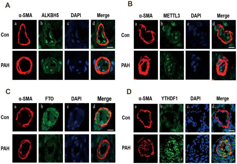 https://cdn.ncbi.nlm.nih.gov/pmc/blobs/d425/8351682/04424ed6ab09/aging-13-203230-g006.jpg