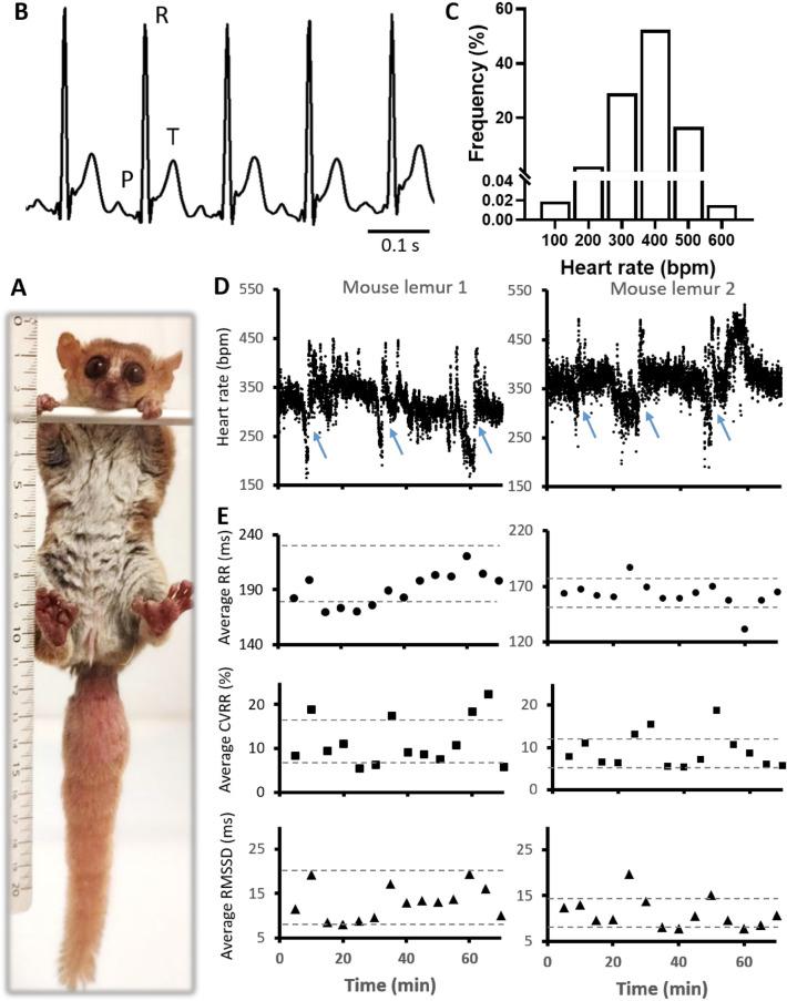 https://cdn.ncbi.nlm.nih.gov/pmc/blobs/d428/9944915/f4d9d9110ba0/41598_2023_29723_Fig1_HTML.jpg