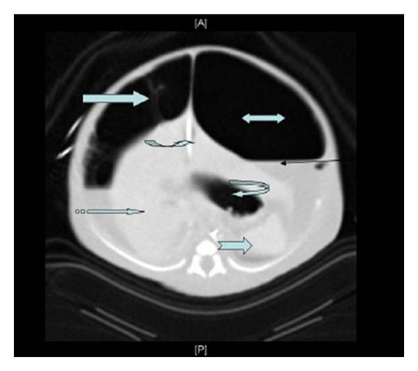 https://cdn.ncbi.nlm.nih.gov/pmc/blobs/d429/3375074/a28d4192dfa6/CRIM.OBGYN2012-593143.003.jpg