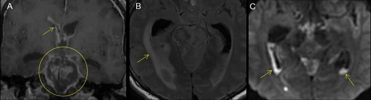 https://cdn.ncbi.nlm.nih.gov/pmc/blobs/d42b/6137902/5df284963f76/gr3.jpg