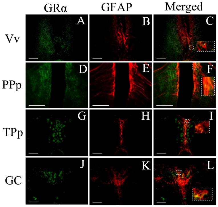 https://cdn.ncbi.nlm.nih.gov/pmc/blobs/d42f/10296162/3326c0d769f1/brainsci-13-00861-g008.jpg
