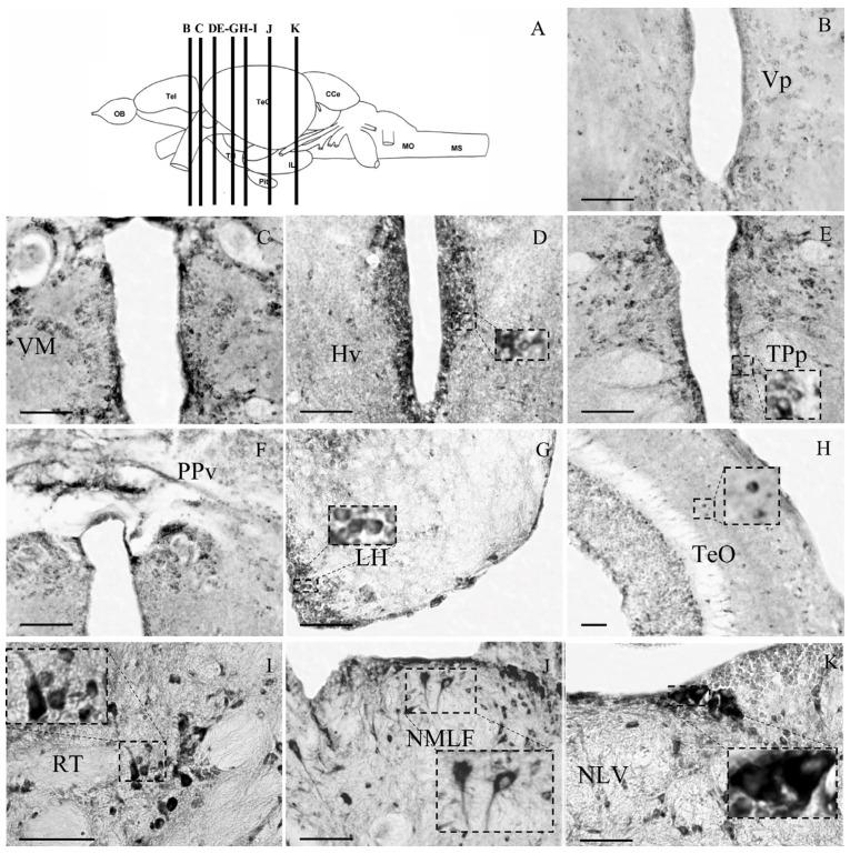 https://cdn.ncbi.nlm.nih.gov/pmc/blobs/d42f/10296162/dc87bae4cd51/brainsci-13-00861-g003.jpg