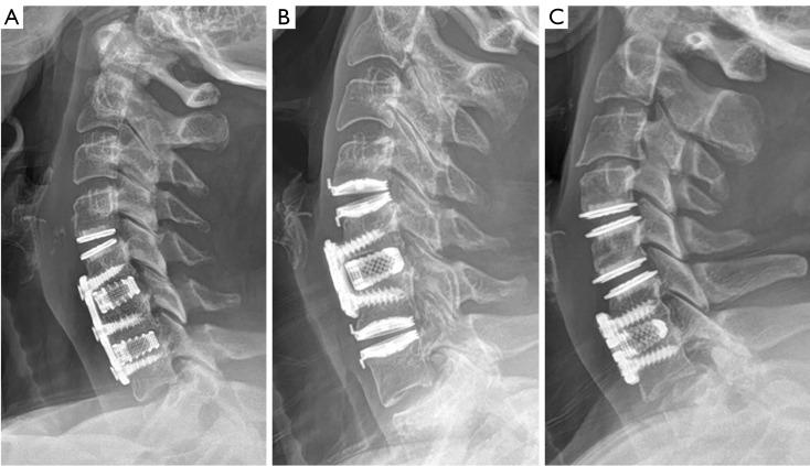 https://cdn.ncbi.nlm.nih.gov/pmc/blobs/d433/11224783/1149faa700d9/jss-10-02-165-f4.jpg