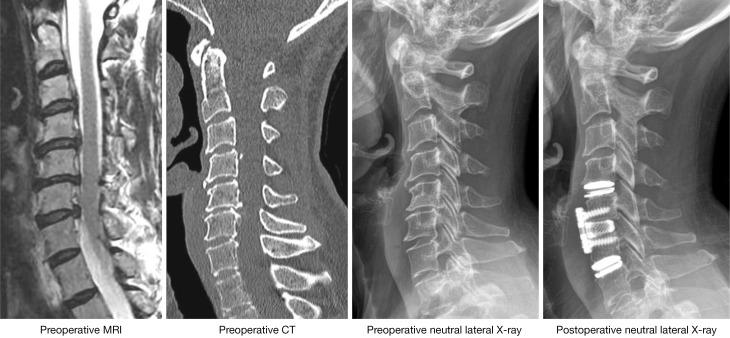 https://cdn.ncbi.nlm.nih.gov/pmc/blobs/d433/11224783/66c2d72058c4/jss-10-02-165-f6.jpg