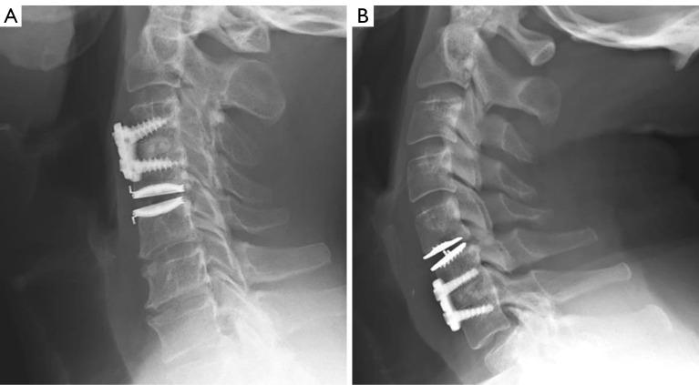 https://cdn.ncbi.nlm.nih.gov/pmc/blobs/d433/11224783/af9ebe265f97/jss-10-02-165-f3.jpg