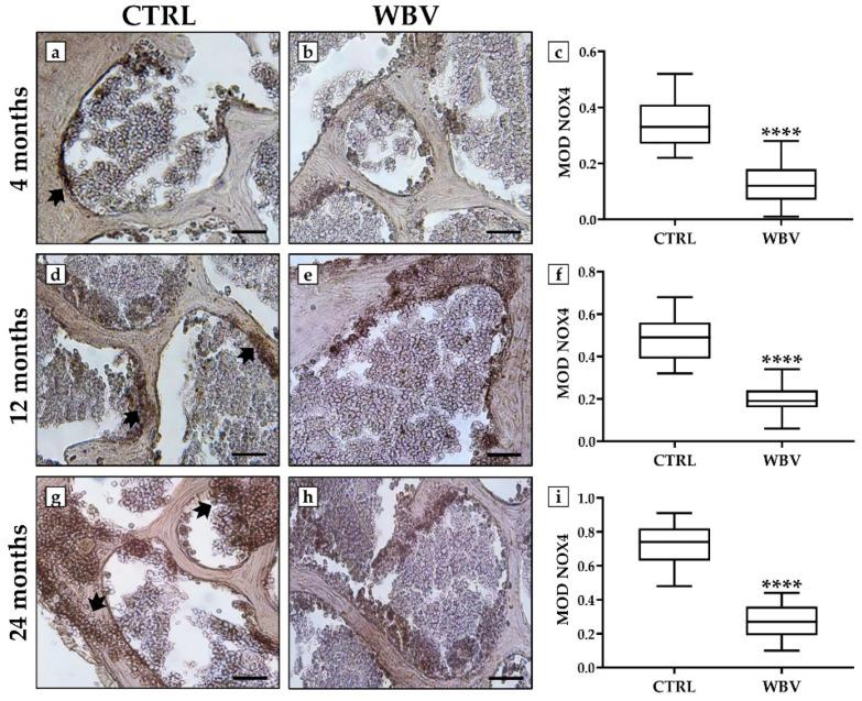 https://cdn.ncbi.nlm.nih.gov/pmc/blobs/d434/11755639/600d6d85b320/jfmk-10-00026-g004.jpg