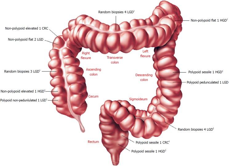 https://cdn.ncbi.nlm.nih.gov/pmc/blobs/d439/6148427/eb4246591a3a/WJG-24-4069-g002.jpg
