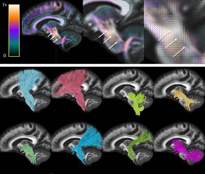 https://cdn.ncbi.nlm.nih.gov/pmc/blobs/d439/8837578/f931ccfcc77d/HBM-43-1196-g008.jpg
