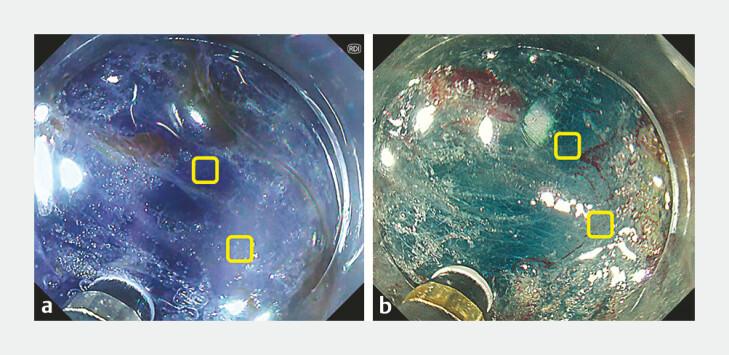 https://cdn.ncbi.nlm.nih.gov/pmc/blobs/d43d/12090977/8066d5bee7a8/10-1055-a-2592-3546_25937824.jpg