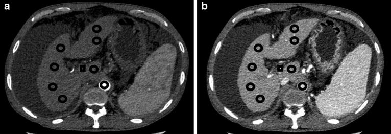 https://cdn.ncbi.nlm.nih.gov/pmc/blobs/d440/8131370/903bf88a2d45/41598_2021_89764_Fig1_HTML.jpg