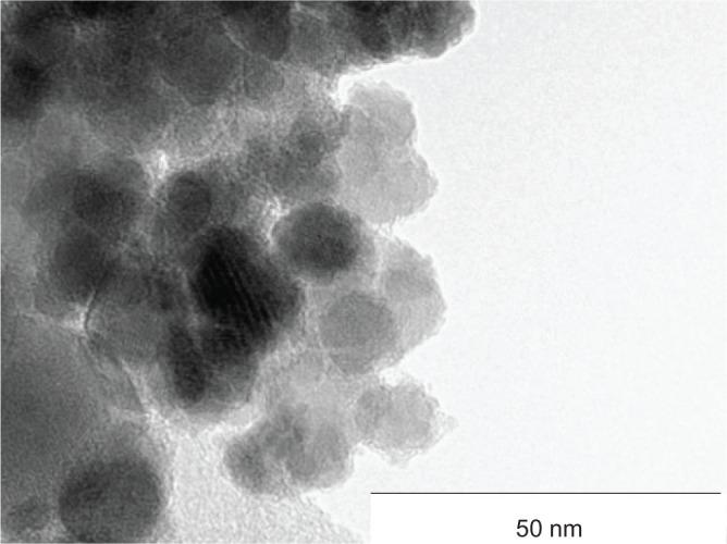 https://cdn.ncbi.nlm.nih.gov/pmc/blobs/d441/4245086/6ad2eadf5885/ijn-9-5355Fig2.jpg