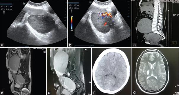 https://cdn.ncbi.nlm.nih.gov/pmc/blobs/d451/5398115/7dbeb9b27dcd/IJMPO-38-81-g001.jpg