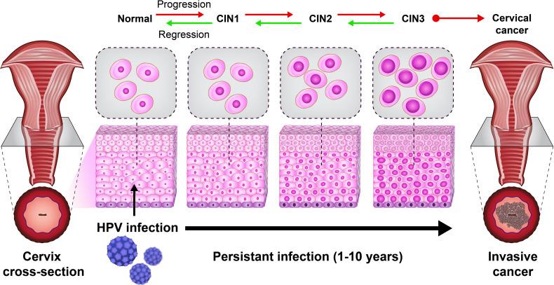 https://cdn.ncbi.nlm.nih.gov/pmc/blobs/d458/8828558/3926256df7d8/fimmu-12-805695-g002.jpg