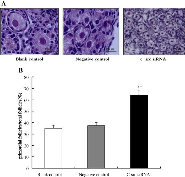 https://cdn.ncbi.nlm.nih.gov/pmc/blobs/d459/3444437/4ad381573e25/1477-7827-10-58-5.jpg
