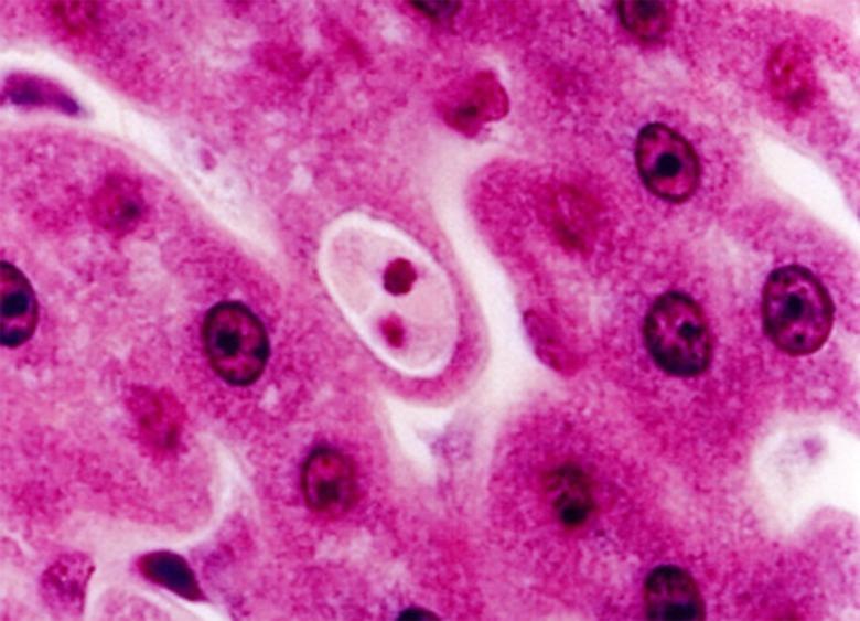 https://cdn.ncbi.nlm.nih.gov/pmc/blobs/d459/4639712/3505dd2cf057/parasite-22-31-fig3.jpg