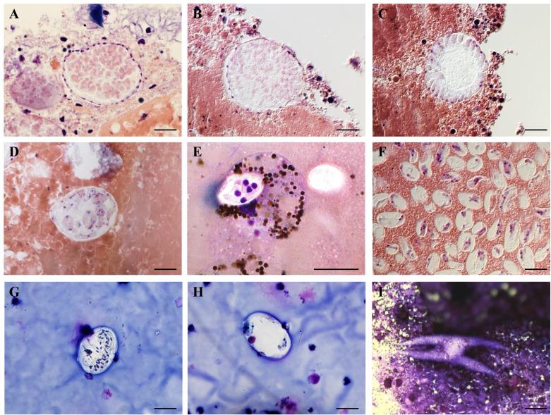 https://cdn.ncbi.nlm.nih.gov/pmc/blobs/d459/4639712/73bfcae3dca2/parasite-22-31-fig1.jpg