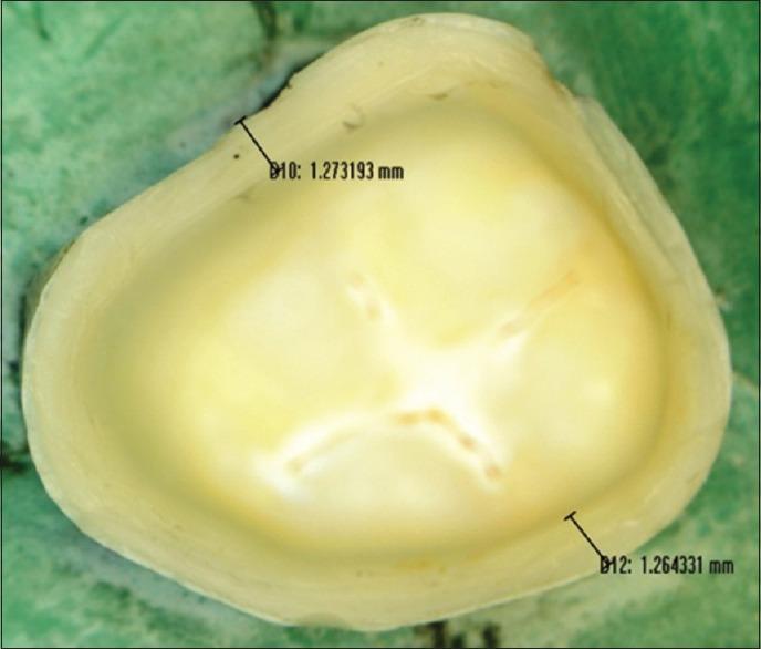 https://cdn.ncbi.nlm.nih.gov/pmc/blobs/d460/4832802/74a47bef2950/JIPS-16-36-g002.jpg