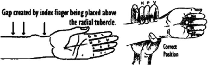 https://cdn.ncbi.nlm.nih.gov/pmc/blobs/d465/11166873/1104229c3419/gr2.jpg