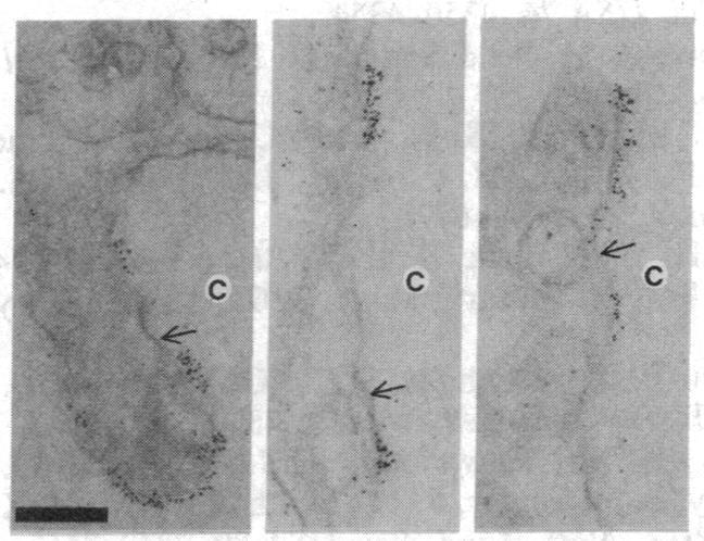 https://cdn.ncbi.nlm.nih.gov/pmc/blobs/d466/397094/1711a17659d1/pnas00342-0378-b.jpg
