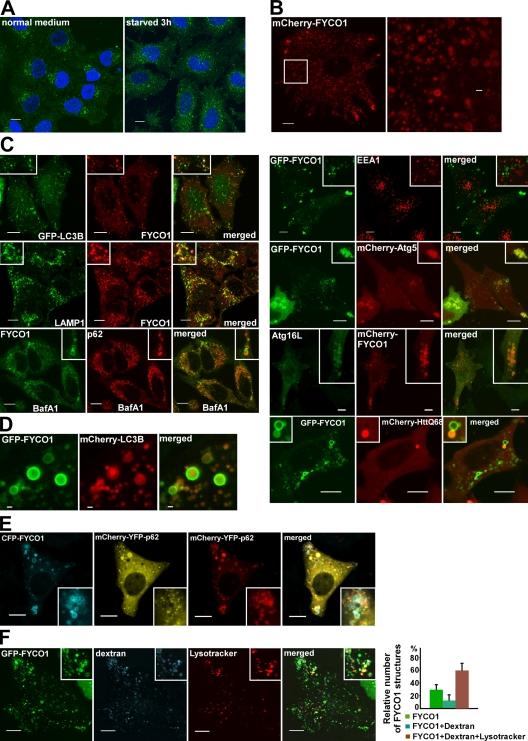 https://cdn.ncbi.nlm.nih.gov/pmc/blobs/d46e/2812517/f7c554379eb6/JCB_200907015_RGB_Fig3.jpg