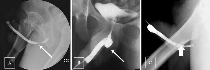 https://cdn.ncbi.nlm.nih.gov/pmc/blobs/d470/7280179/103e03975ee8/261_2019_2356_Fig16_HTML.jpg
