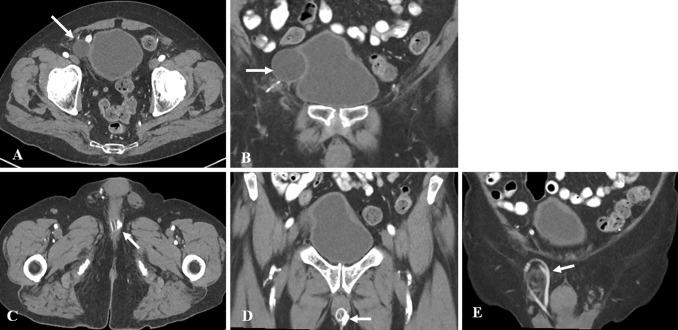 https://cdn.ncbi.nlm.nih.gov/pmc/blobs/d470/7280179/566d660a2aeb/261_2019_2356_Fig25_HTML.jpg