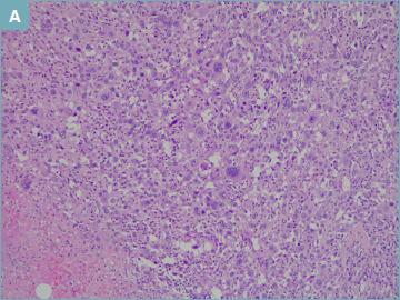https://cdn.ncbi.nlm.nih.gov/pmc/blobs/d473/10342216/9ca3a81cdf0d/pathol-2023-01-32-g003.jpg
