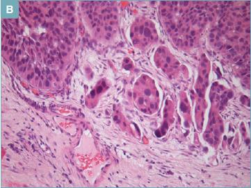 https://cdn.ncbi.nlm.nih.gov/pmc/blobs/d473/10342216/a430a6ab1403/pathol-2023-01-32-g002.jpg