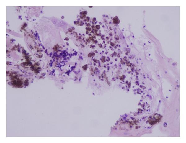 https://cdn.ncbi.nlm.nih.gov/pmc/blobs/d483/4119646/e7b9c5b5fa20/BMRI2014-574825.004.jpg